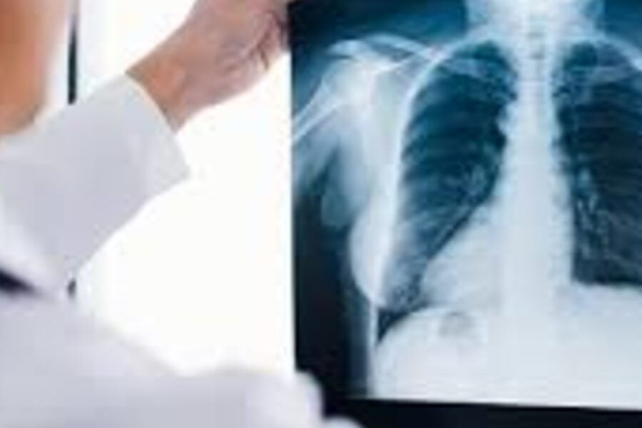 Médico analisando radiografia de tórax